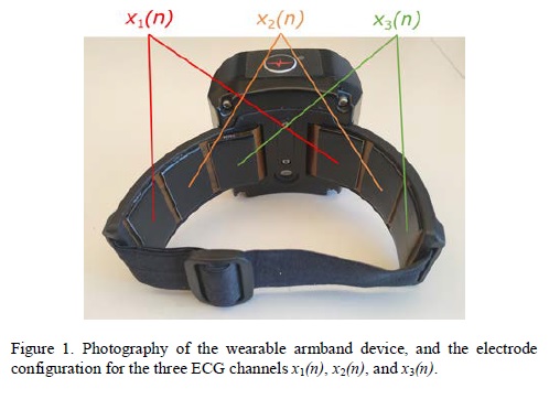 A wearable armband gets to the heart of the matter