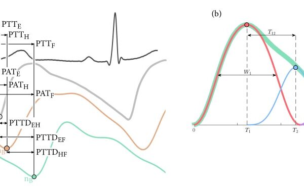 Vascular reactivity characterized by PPG-derived pulse wave velocity